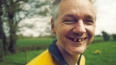 Julian Assange Teeth