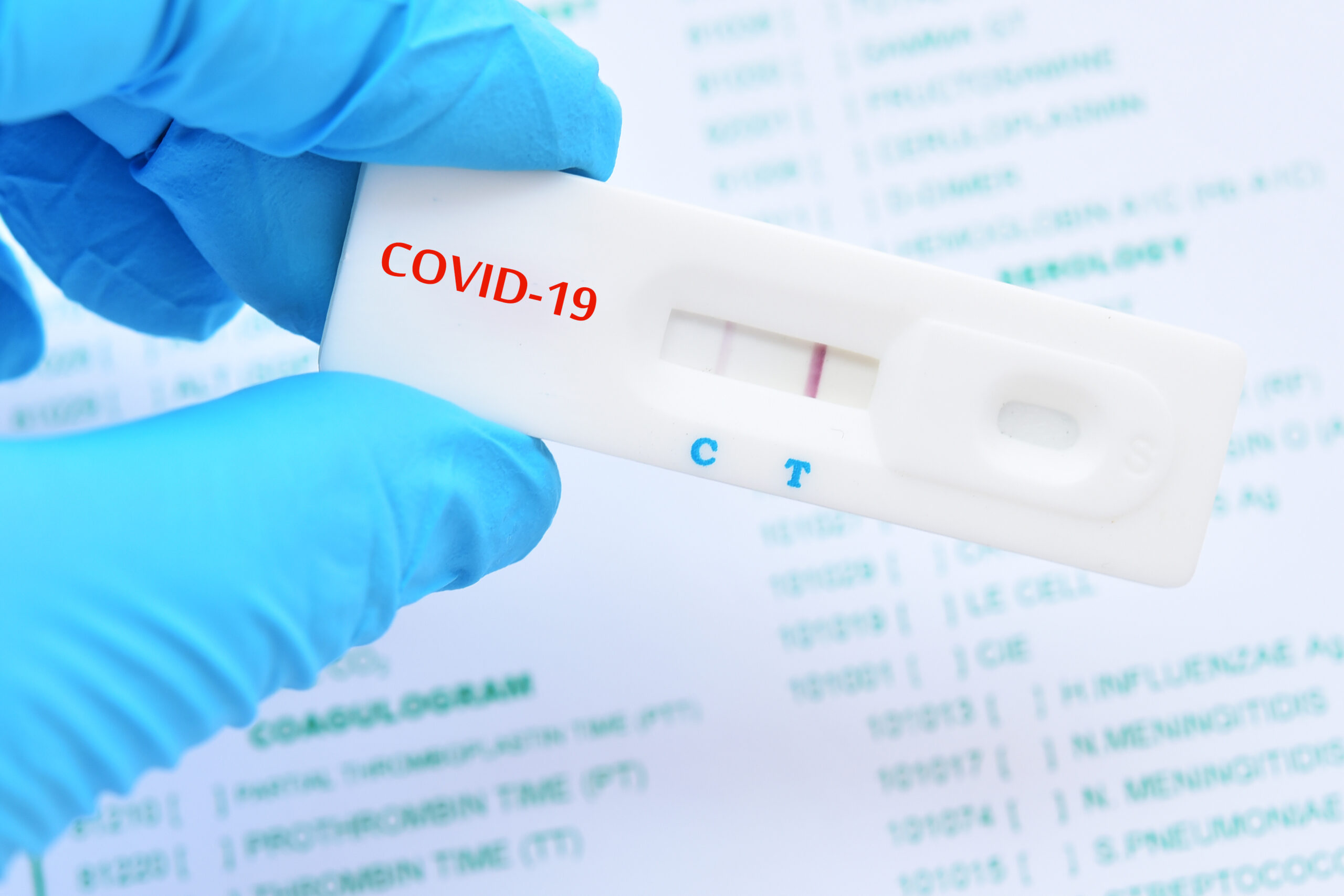 COVID-19 PCR Test