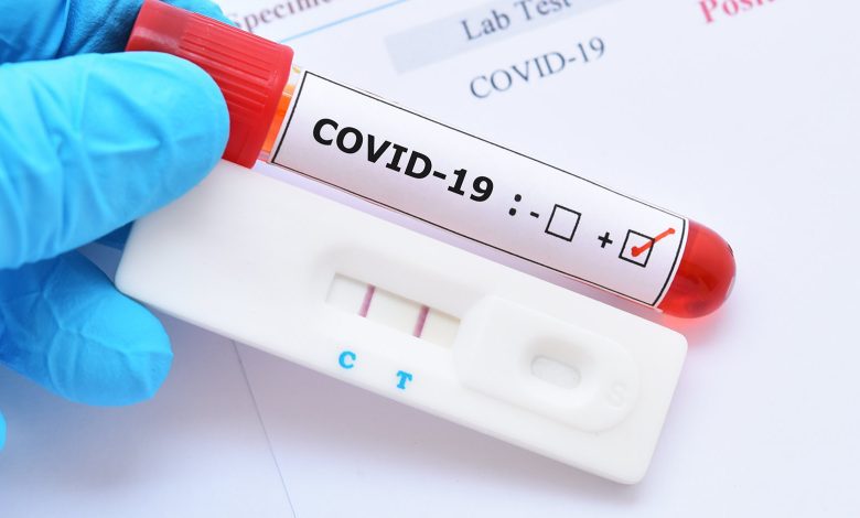 COVID-19 PCR Test