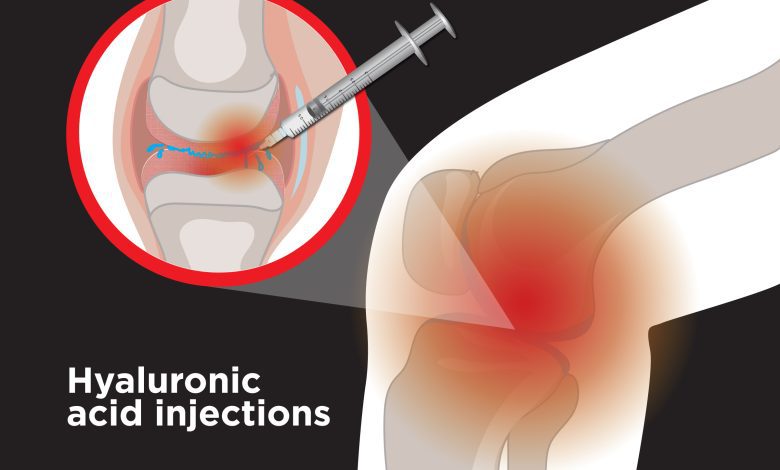 ACID INFILTRATION IN THE KNEE