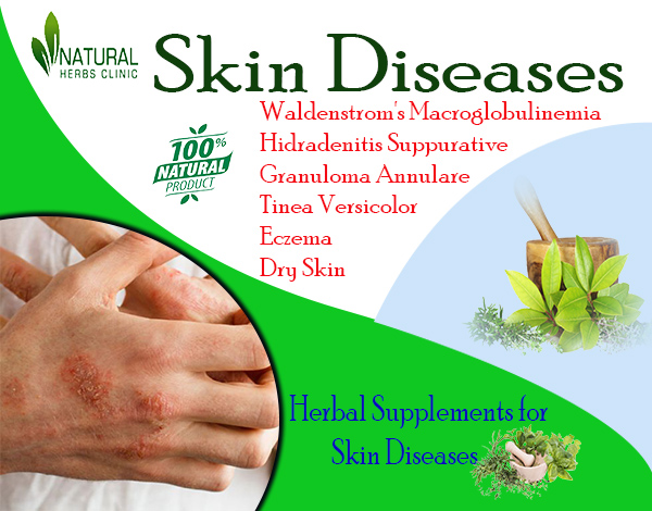 Herbal Supplements for Skin Disease