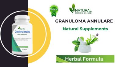 Herbal supplements for Granuloma Annulare