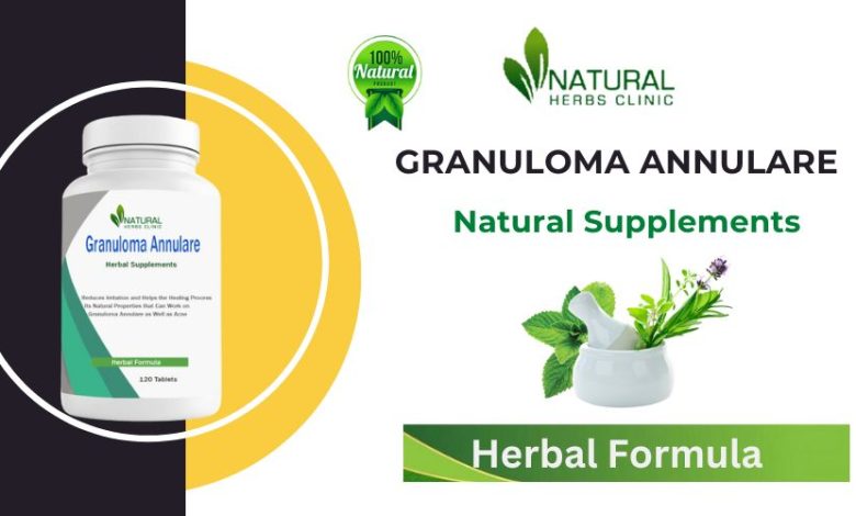 Herbal supplements for Granuloma Annulare