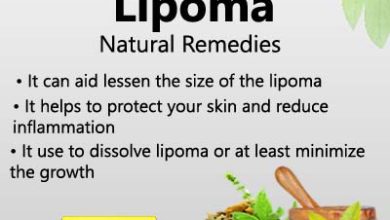 Home Remedies for Lipoma Removal