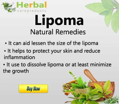 Home Remedies for Lipoma Removal