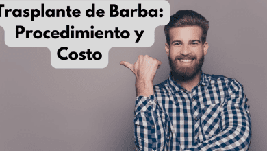 Trasplante de Barba