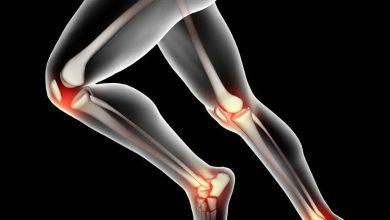 Osteoarthritis Treatment