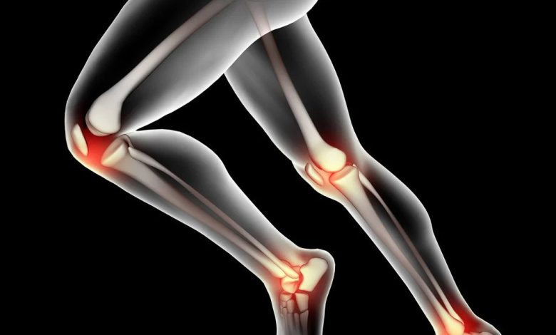 Osteoarthritis Treatment