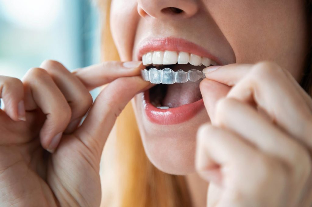 Orthodontic