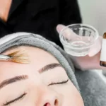 Chemical Peel