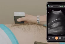 Wireless Ultrasound Scanners