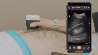 Wireless Ultrasound Scanners