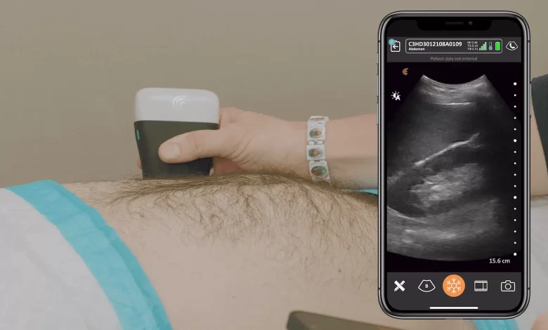 Wireless Ultrasound Scanners