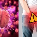 sexually transmitted infections