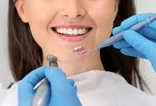 Dental Teeth Filling melbourne