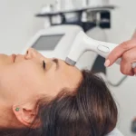 laser skin tigtening