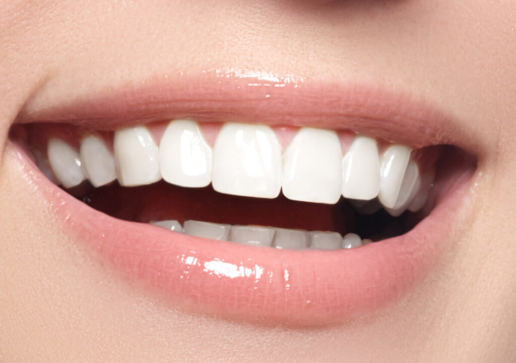 complete dental care in Philadelphia and Montgomery